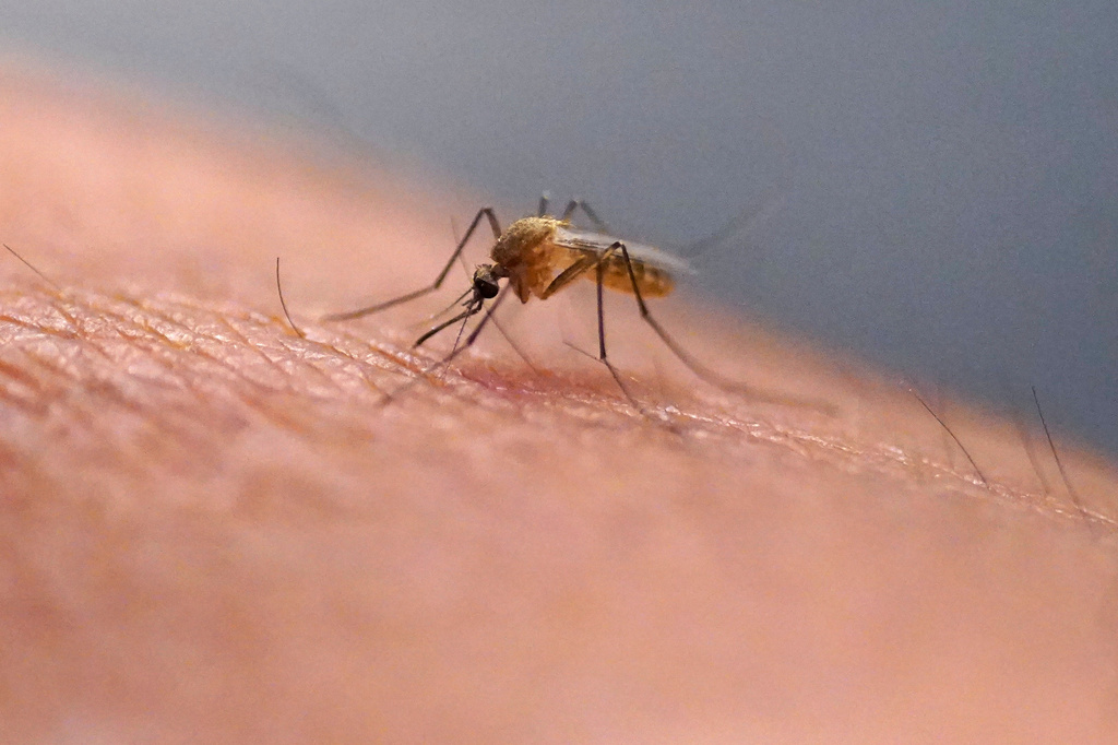 Scratching an itch can make it worse, study finds