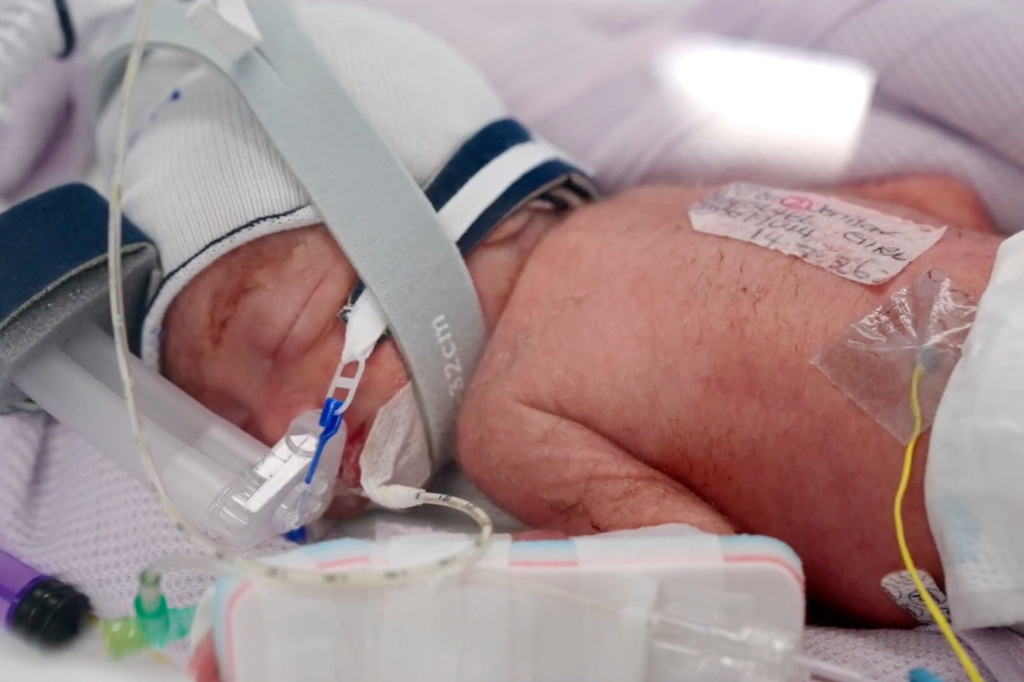 Australian woman gives birth to quadruplets